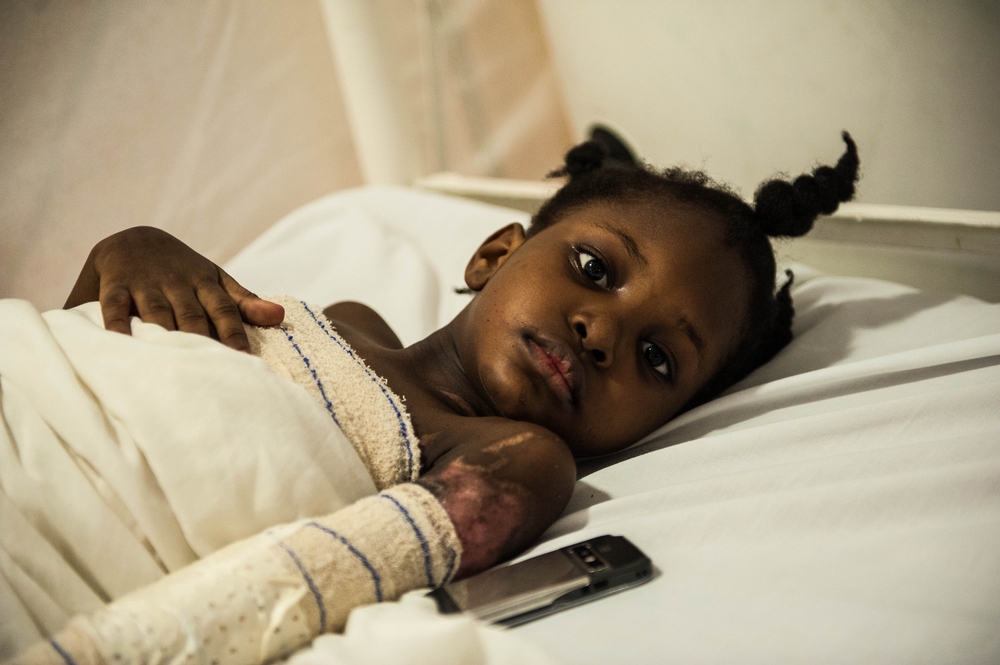 © Y Libessart Hôpital MSF de Drouillard. Grièvement blessée, cette petite fille se rétablit progressivement.