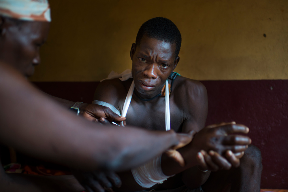 Gervais, 25 ans, a été touché par balles lors d'une attaque dans son village. © Colin Delfosse. République centrafricaine, mars 2017.