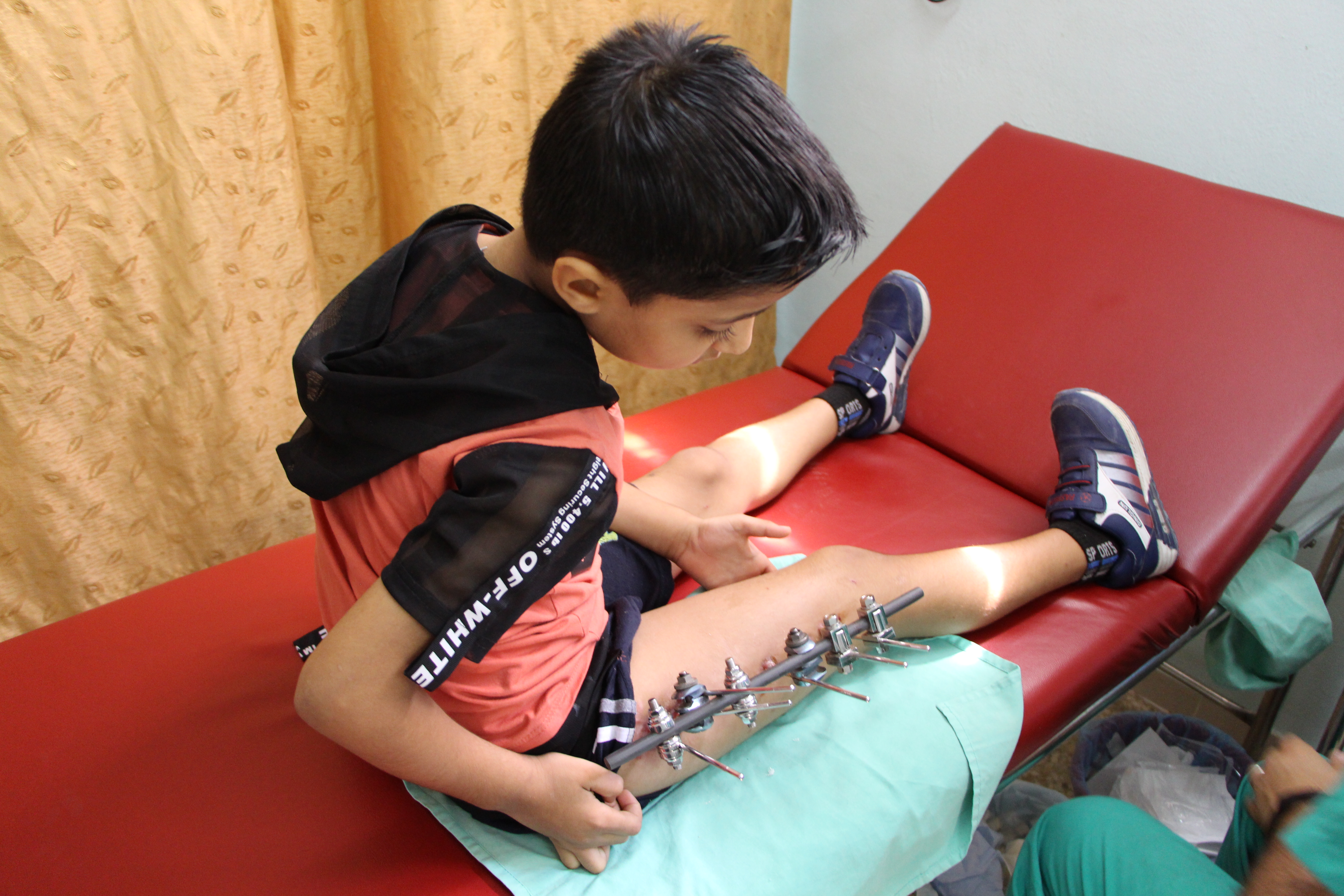 Un garçon de huit ans se trouve au dispensaire de soins postopératoires de MSF où il se rend tous les jours pour faire changer les pansements autour de son fixateur externe. Il s'est fracturé la cuisse lors d’une chute durant une des manifestations © Alva Simpson White/MSF
