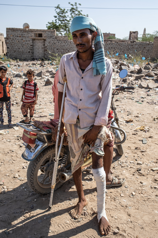 Een van de vele burgerslachtoffers. Deze man was op weg naar zijn vader, wanneer hij op een gewond geraakte door een springtuig. Hij werd meteen overgebracht naar het ziekenhuis in Aden. 