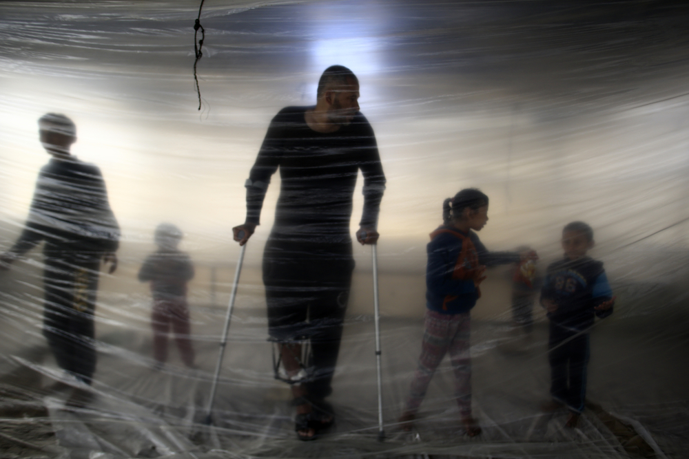 Ahmed, un Palestinien de 38 ans, est l’un des 7.000 Palestiniens blessés par l’armée israélienne depuis le 30 mars 2018 lors de manifestations près de la frontière entre Gaza et Israël. Les blessures, principalement sur les membres inférieurs, nécessitent des traitements longs, douloureux et complexes. Les victimes en souffrent toujours des mois plus tard.