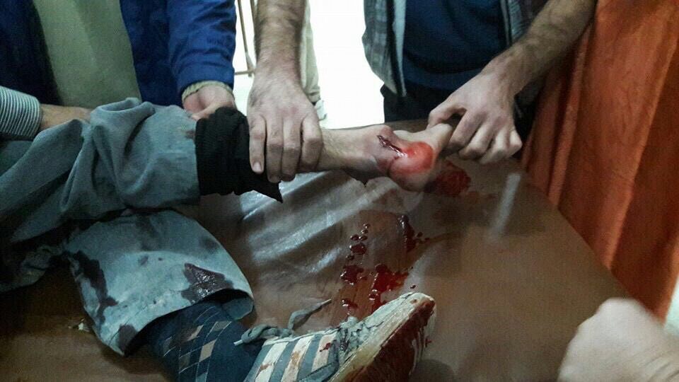 Na het afschuwelijke tweeledige bombardement op het door AZG ondersteunde ziekenhuis in Al Zafarana moesten 47 gewonden dringend overgebracht worden naar andere ziekenhuis. Op deze foto wordt één van die patiënten getrieerd in dat ziekenhuis. De foto is genomen door een arts die door Artsen Zonder Grenzen gesteund wordt. 