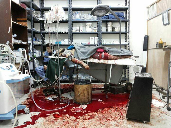 Un homme git gravement blessé sur une table d’opération d’un hôpital de campagne dans une région assiégée dans l’Est de Damas. Photo prise par un des médecins travaillant  avec le soutien de MSF en juillet 2013. © MSF