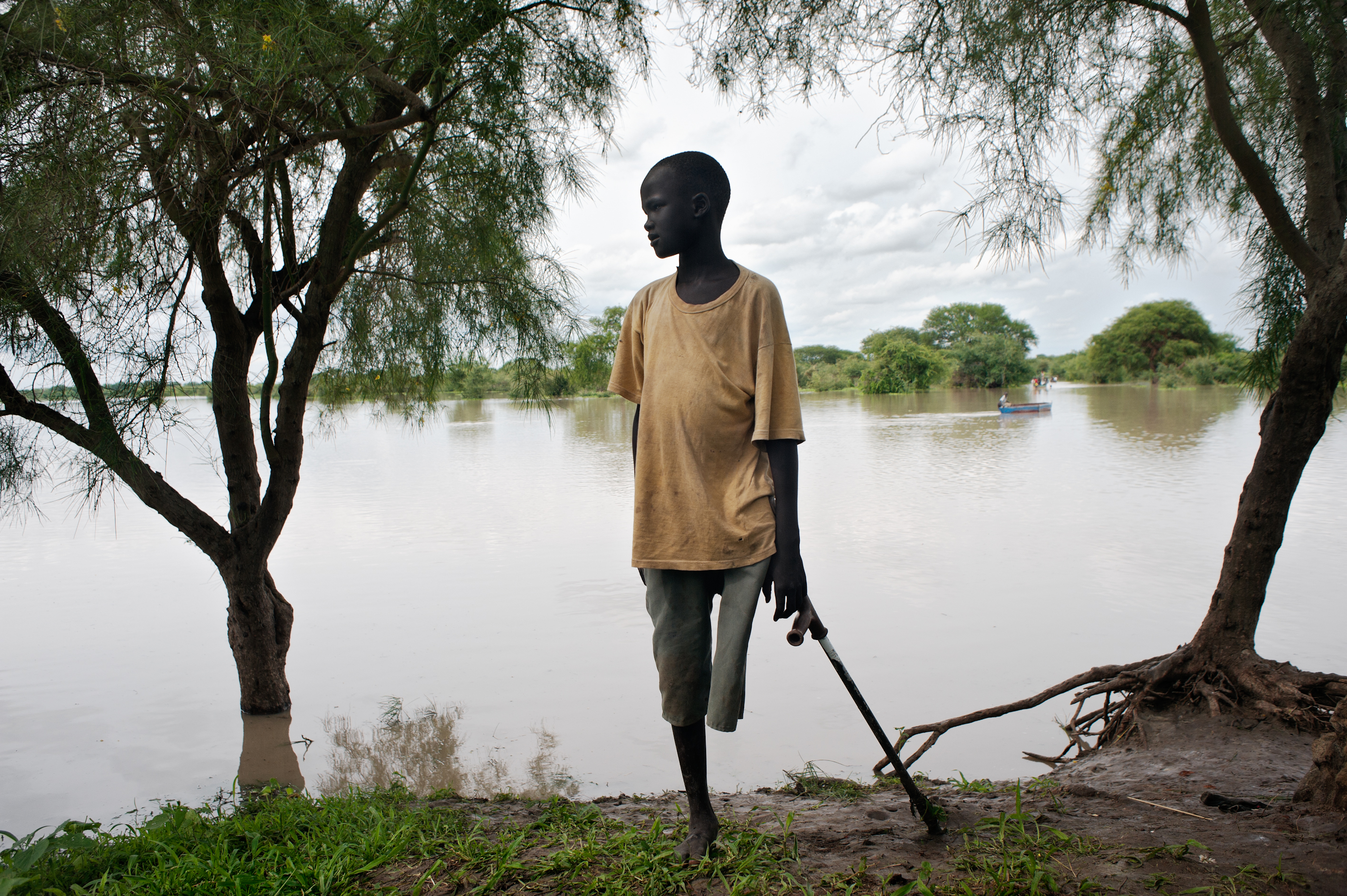 Het been van deze jongen werd geamputeerd na een slangenbeet, die niet tijdig verzorgd kon worden. Jonglei-staat, Zuid-Sudan. © Cédric Gerbehaye/Agence Vu