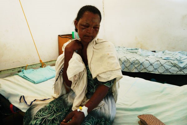 Workey Mekonen uit Ethiopië  werd door een slang gebeten toen ze aan het koken was voor migrerende arbeiders. We voerden een bloedtest uit om na te gaan of er gif in haar bloed was terechtgekomen. De bloedtest is een betrouwbaar middel om snel te bepalen of de patiënt tegengif nodig heeft. © Susanne Doettling/AZG.