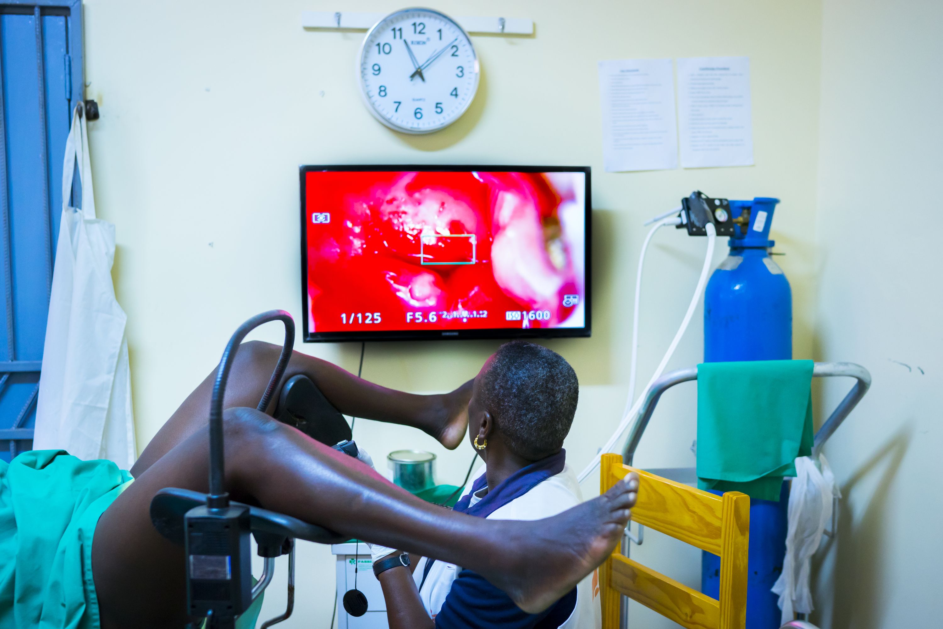 Une infirmière exécute un test VIAC sur une patiente à l’hôpital rural de Gutu © Mélanie Wenger