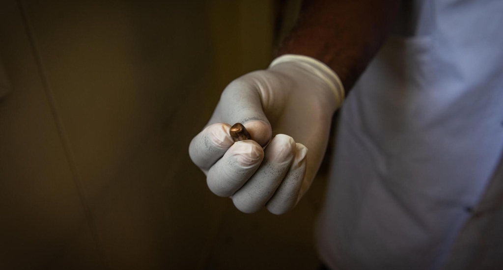 Un médecin montre le projectile qui vient d’être extrait du corps d’un patient, blessé par une balle perdue à Port-au-Prince